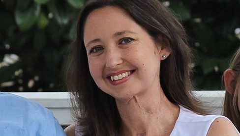 口腔癌幸存者Jeannie Hopper