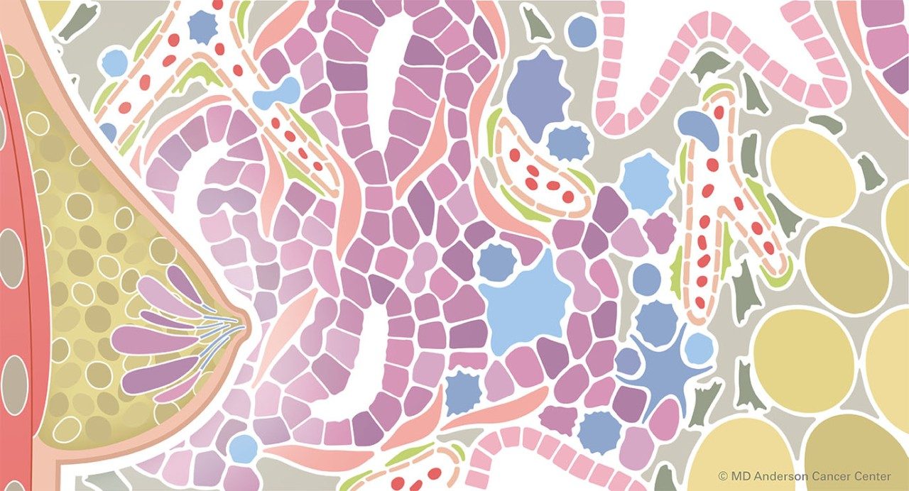 乳房的彩色插图，在肿瘤微环境的描绘前面带有小叶