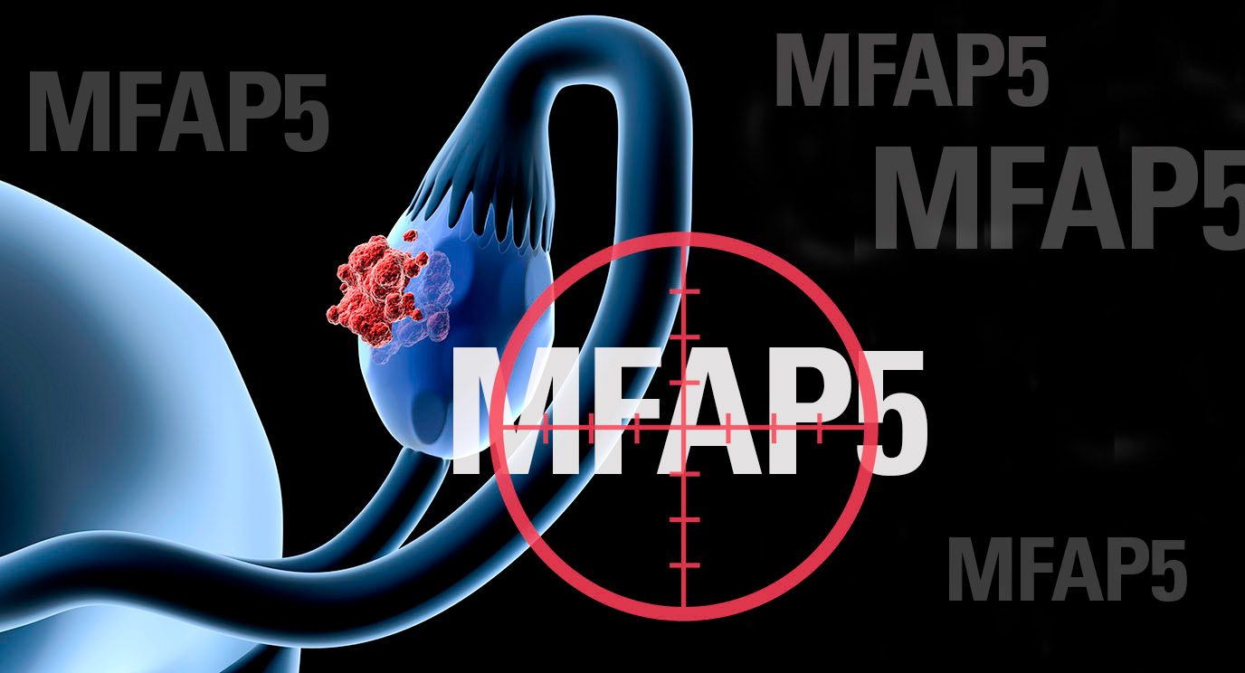 188bet体育网址研究人员发现，针对在小鼠模型中MFAP5蛋白减少参与了卵巢癌和胰腺癌的纤维化。