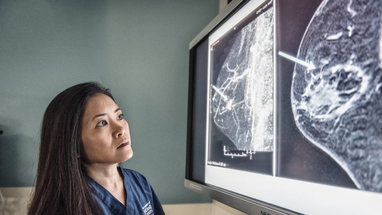 Cancerwise博客文章：乳腺癌，椎管内肿瘤的临床试验为未来的癌症治疗方法的承诺