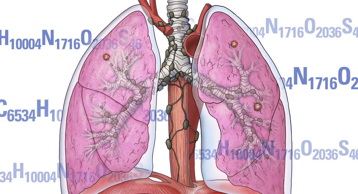 免疫疗法临床试验使用免疫检查点阻断药物Pembrolizumab对癌前生生长以防止它们对肺癌的进化。